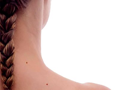 Casco, arnés, guantes, gafas… Pero ¿estás bien protegido del sol? cancer